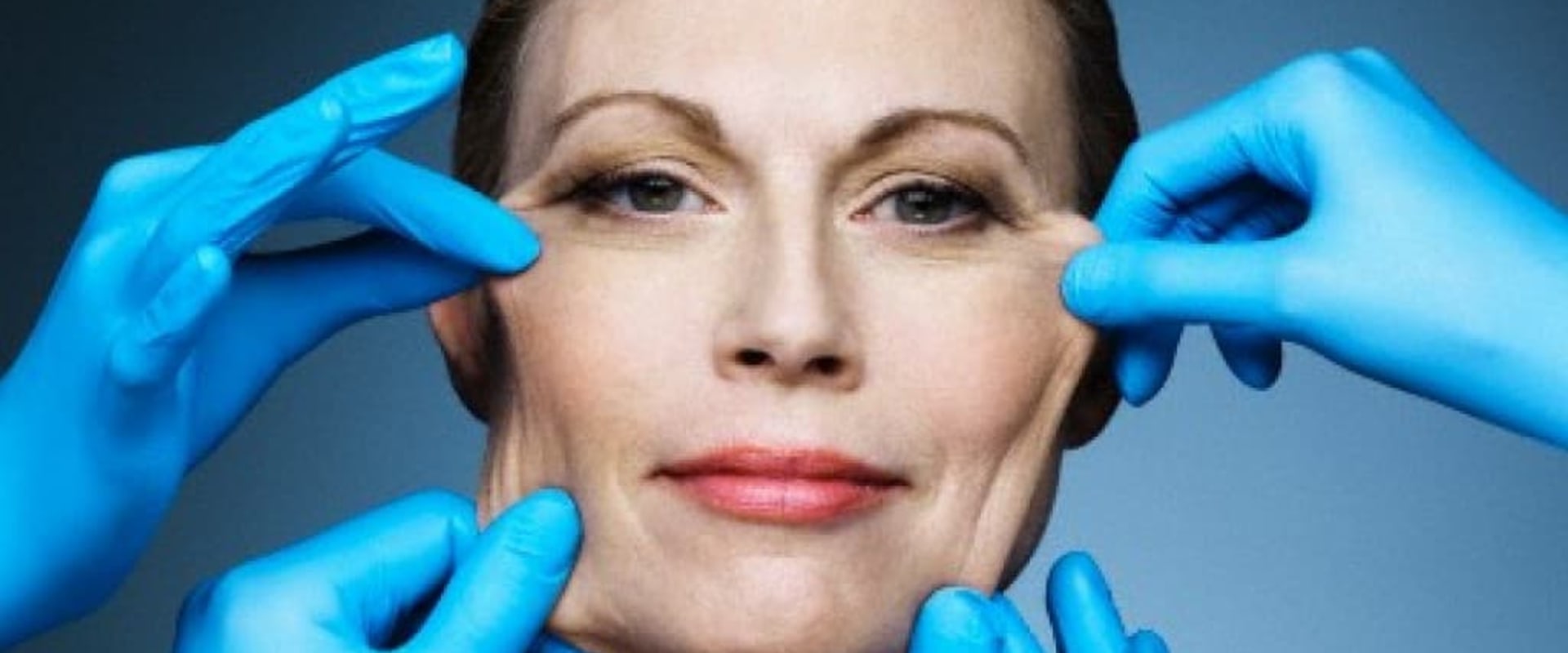 Who is not a good candidate for a facelift?