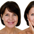 How Much Does a Facelift Cost in the UK?