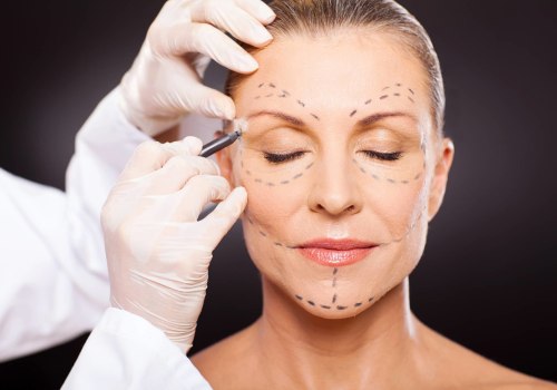Can a Facelift Make You Look 20 Years Younger?