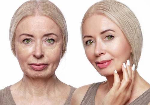 What is the price of a facelift in turkey?