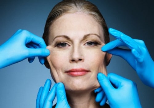 Who is not a good candidate for a facelift?